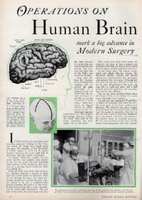 geschiedenis eerste hersentumor operatie 1923 anestesie