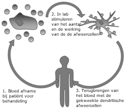 dendritische immunotherapie bloed celtherapie hersentumor kanker